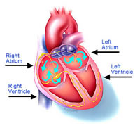 life insurance for people with arterial fibrillation